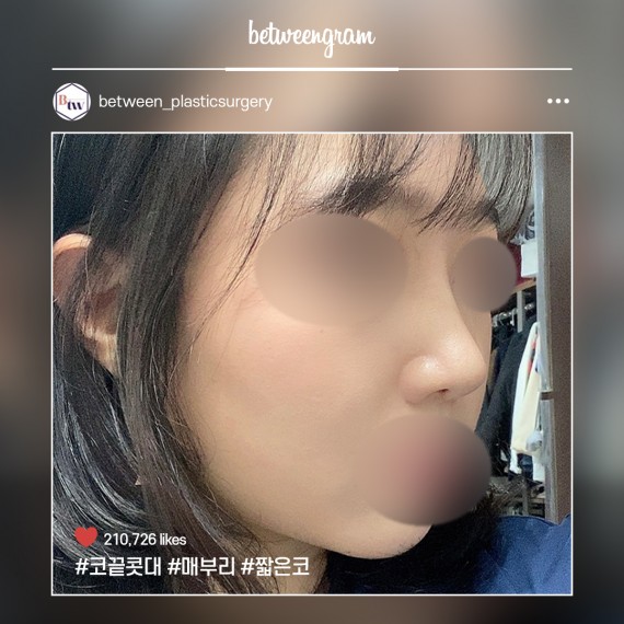 비…