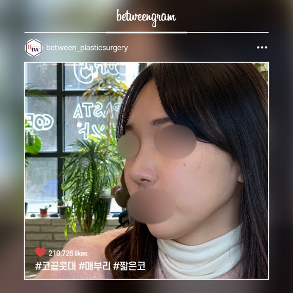 비…