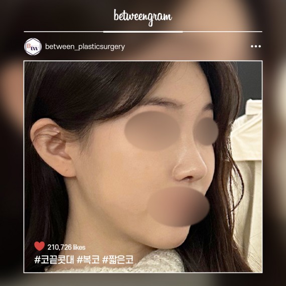 비…