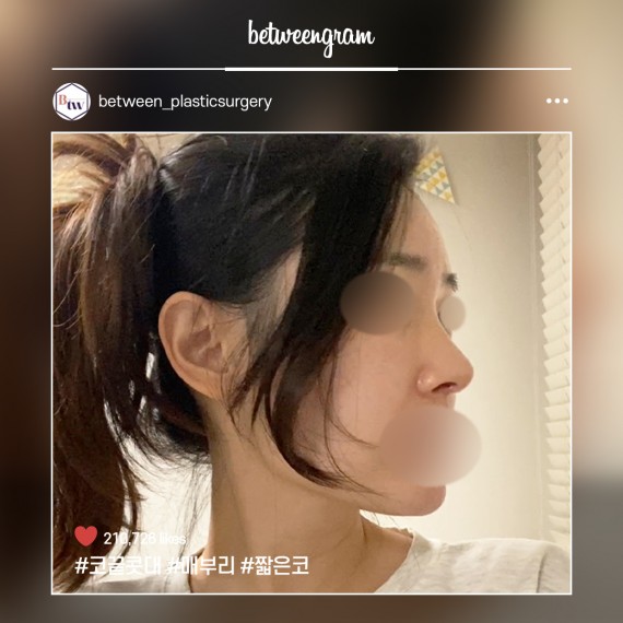 비…